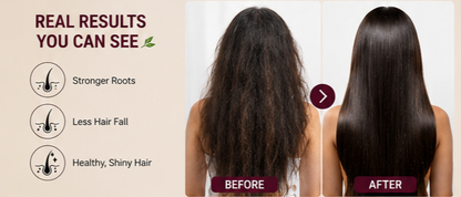 Excalvo Onion Shampoo (Pack of 2)